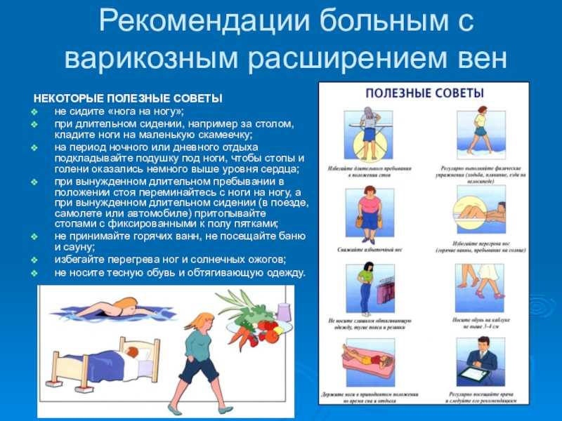 План тренировок при варикозе