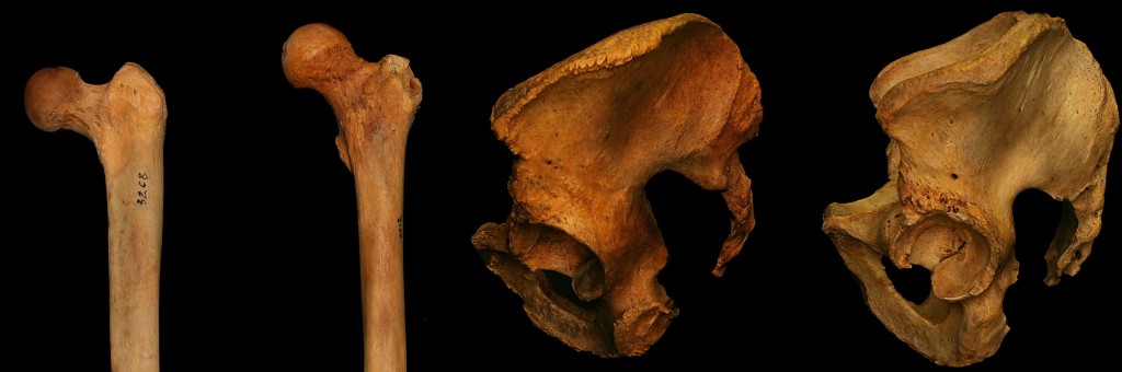 A pair of different femurs and hips.