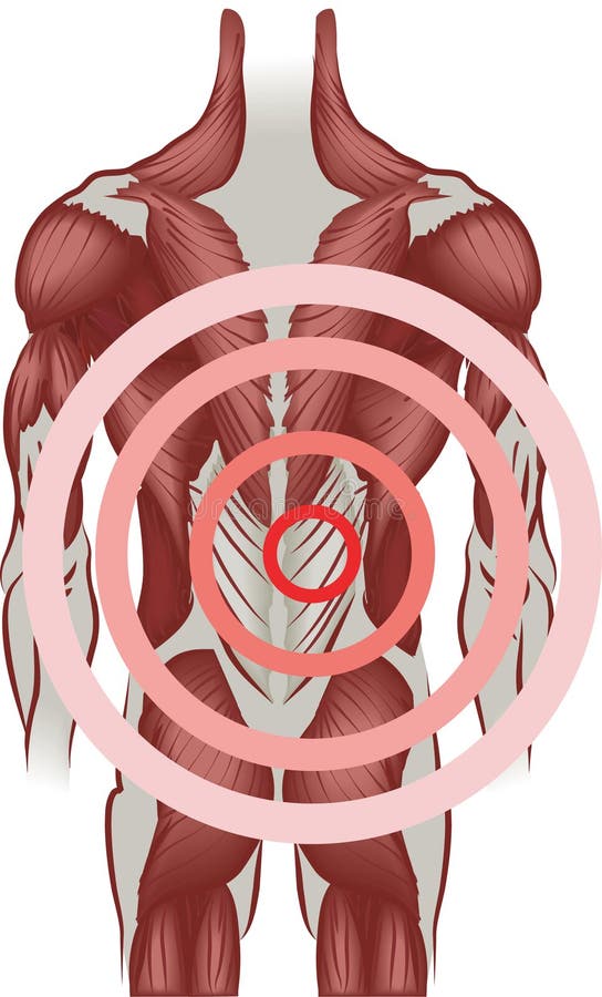 Back pain. Muscles of the back radiating pain. No meshes used royalty free illustration