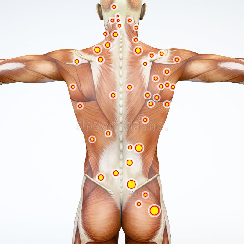 Back view of a man and his trigger points. Anatomy muscles. 3d rendering. Myofascial trigger points, also known as trigger points, are described as stock illustration