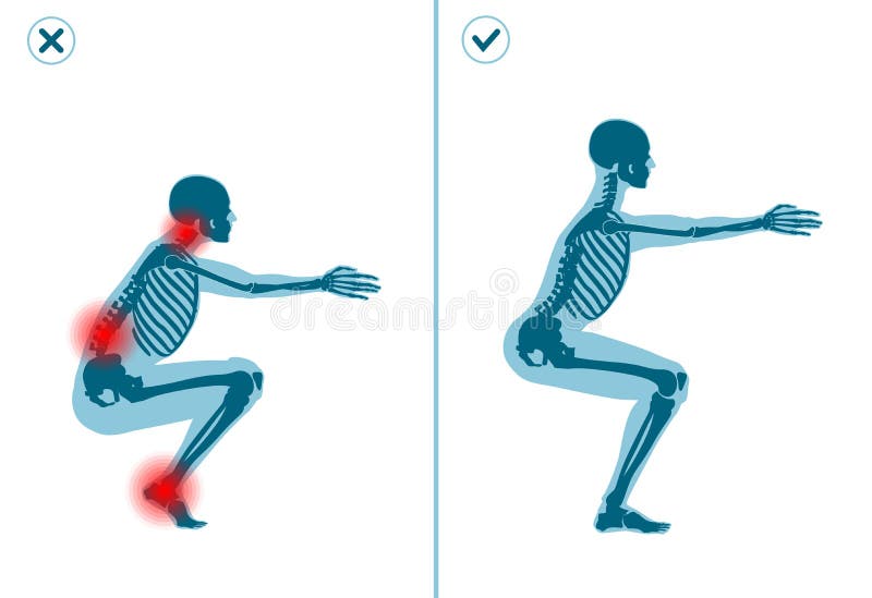 Wrong and correct air squat exercise. Right execution technique of sport gymnastics. Common mistakes in sport workout. Wrong and correct air squat exercise stock illustration