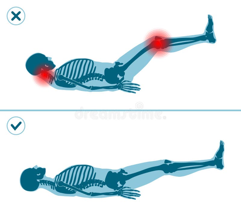 Wrong and correct Leg Raise Drop. Right execution technique of sport gymnastics. Common mistakes in sport workout. Wrong and correct Leg Raise Drop. Right and stock illustration