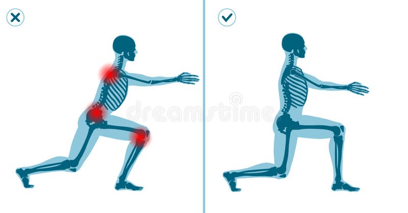 Wrong and correct lunges exercise. Right execution technique of sport gymnastics. Common mistakes in sport workout. Wrong and correct lunges exercise. Right and royalty free illustration