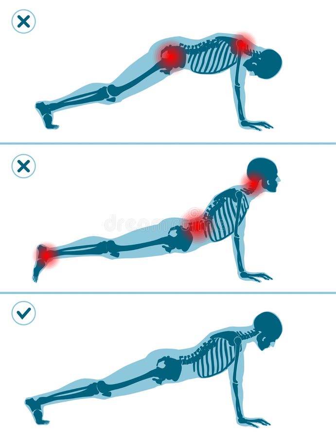 Wrong and correct plank pose. Right and wrong execution technique of sport exercise. Common mistakes in sport workout. Man standing on hands before push ups royalty free illustration