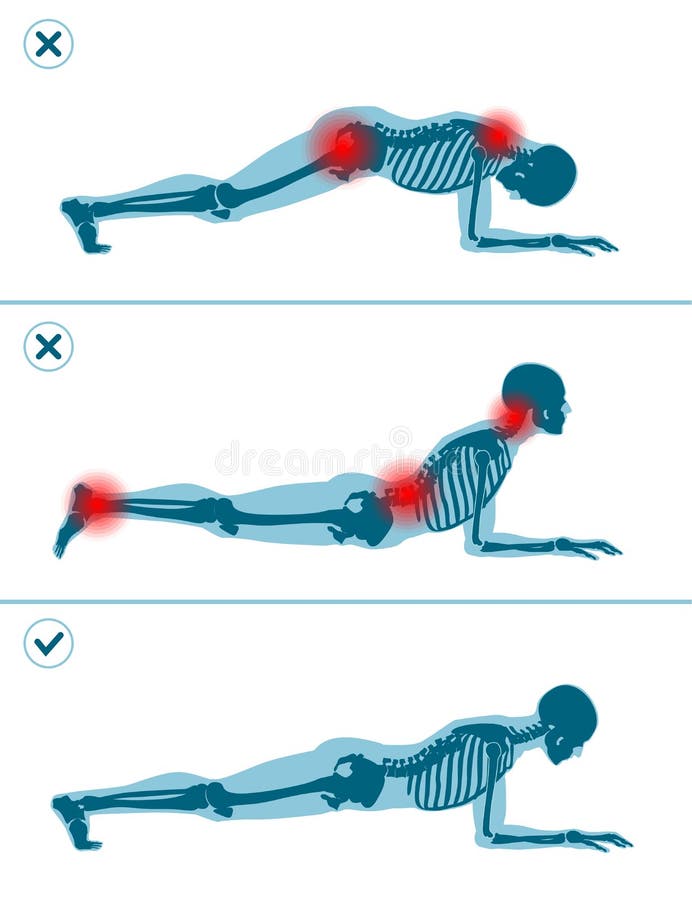 Wrong and correct plank position. Right and wrong execution technique of sport exercise. Common mistakes in sport. Workout. Man standing on elbows royalty free illustration