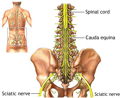 How To Relieve Sciatica Pain