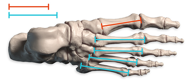 metatarsal length